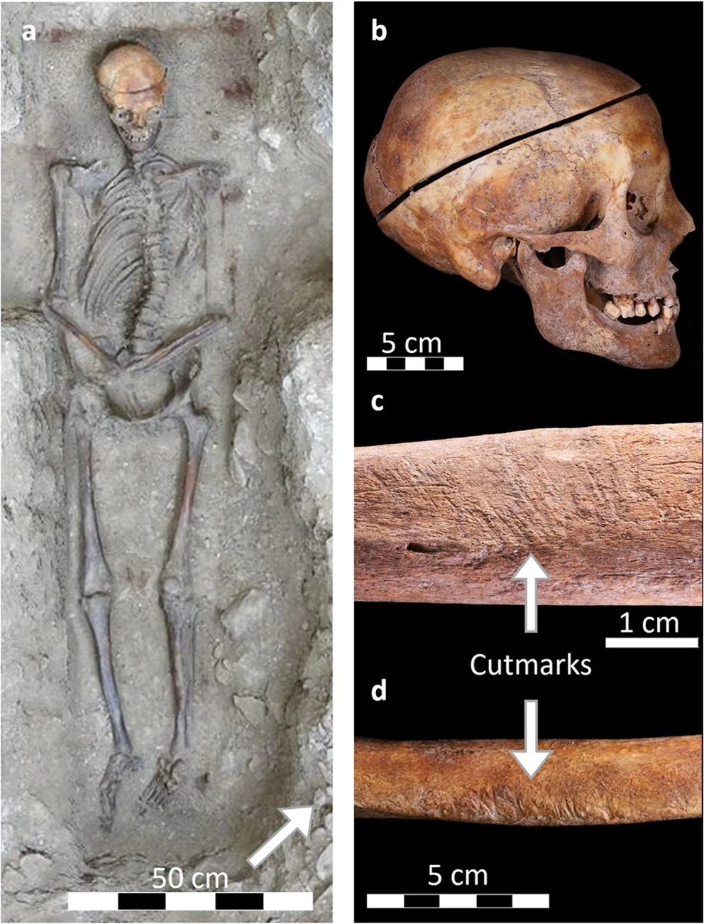 Evidence found of only known familial practice of long-term embalming in Early Modern France